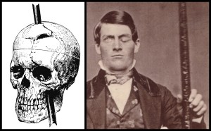 om ini namanya Phineas Gage *gambar ini dicolong dari web ibi http://www.scilogs.com/psychophilosophy/adam-lanza-or-the-genes-of-a-mass-murderer/
